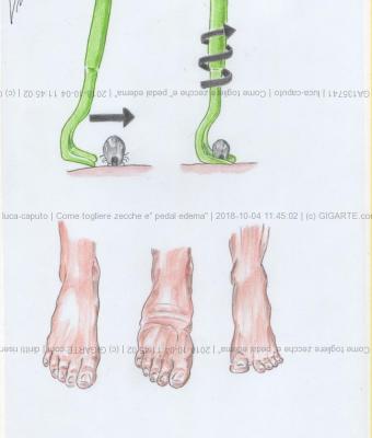 come-togliere-zecche-e-pedal