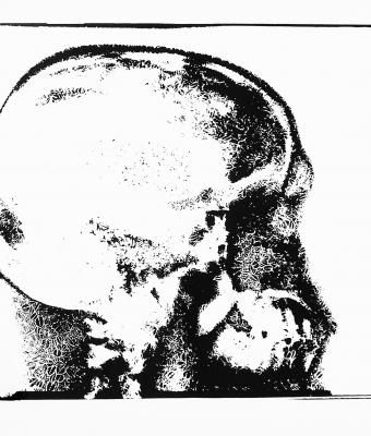 rx-cranio-laterolaterale-12