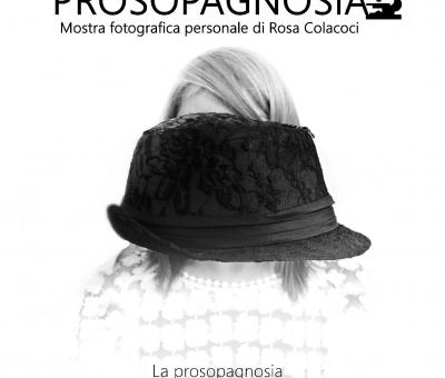 prosopagnosia